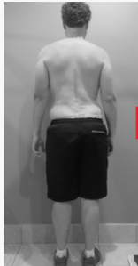 steve bw before